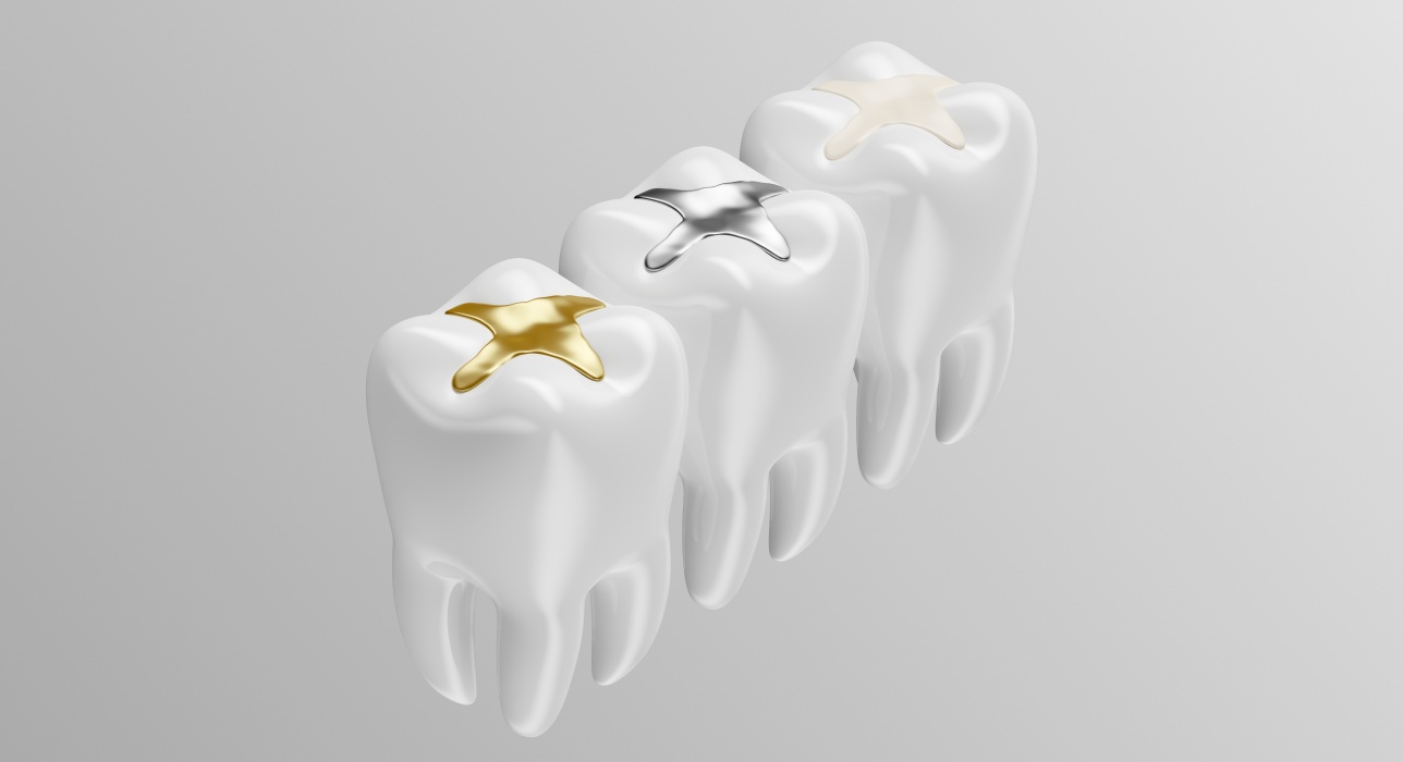 Dental Fillings West Chester, Ohio