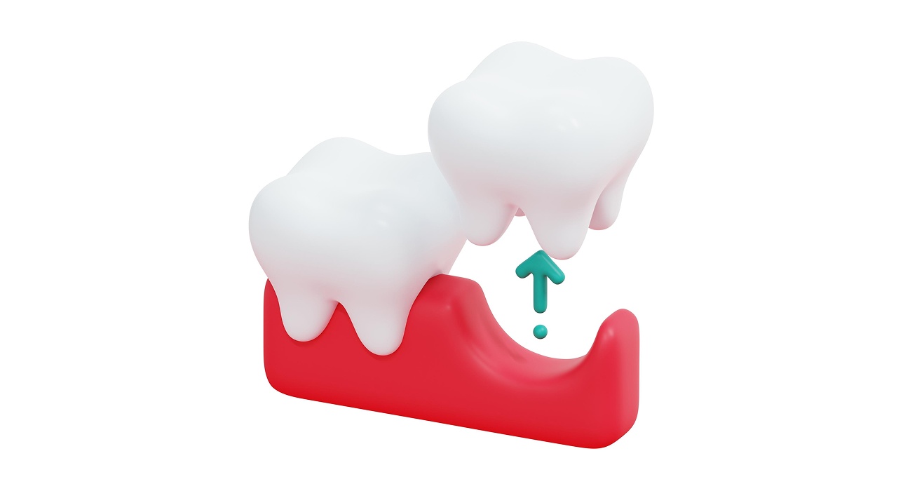 Tooth Extraction in West Chester, Ohio